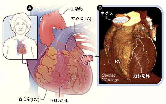 冠心病需要做哪些檢查？(圖2)